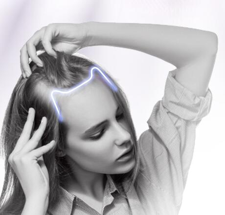 掉头发厉害怎么调理 四个方面的调理阻止头发掉落