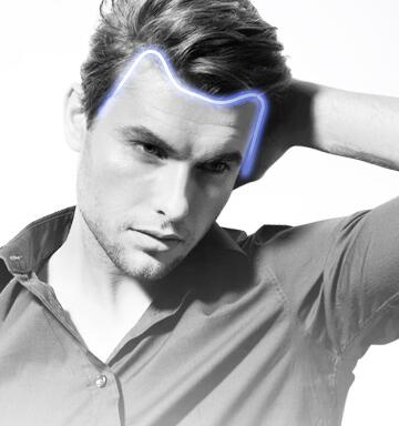 男性脱发治疗方法 详解不同情况脱发的治疗方法