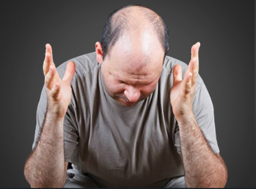 如何判断自己是否脱发 正确了解脱发和改善方法