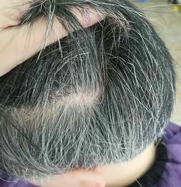 白发能治吗 盘点五个改善白发的方法