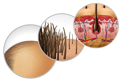 毛囊炎快速消除的小妙招 四个方法改善毛囊炎