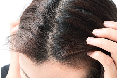 国家承认的三大植发机构 盘点三大正规的植发机构