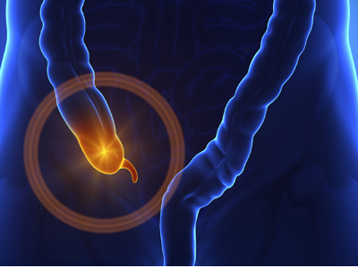 为什么阑尾会发炎 三大可能原因分析